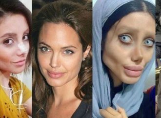 Pour ressembler à Angelina Jolie Sahar Tabar s’est faite opérer 50 fois.