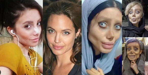 Pour ressembler à Angelina Jolie Sahar Tabar s’est faite opérer 50 fois.