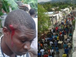 Petit-Goaves :13 manifestants blessés par balles