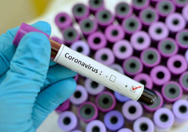Coronavirus: Rencontre entre une délégation de l’OPS et Joseph Jouthe