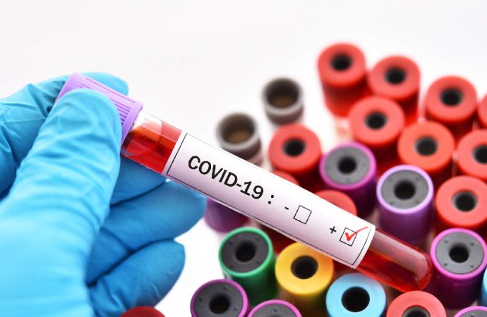 République Dominicaine-Coronavirus: 5300 cas confirmés pour un record de 256 nouveaux cas, ce mercredi