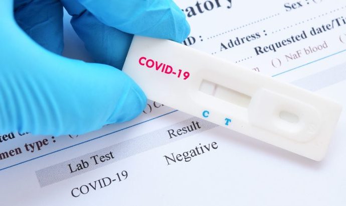 L’État haïtien bientôt à court de test de Coronavirus ?