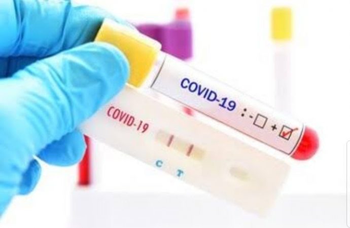 Haïti-Coronavirus : 123 nouveaux cas confirmés et un décès