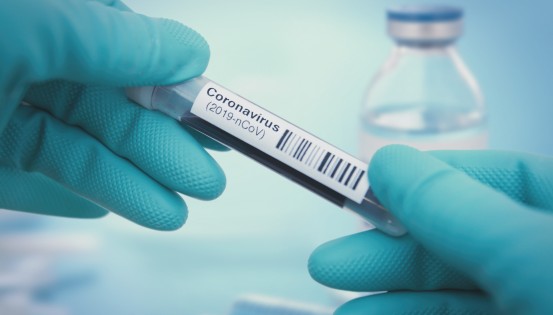 Coronavirus: 86 nouvelles contaminations et 1 décès de plus