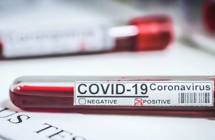Haïti-Coronavirus : 281 nouveaux cas et 3 décès