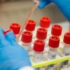 Coronavirus : 38 nouveaux cas confirmés, 6371 au total
