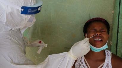 COVID-19 : Haïti dépasse le seuil de 150 décès, 47 nouveaux cas de contamination