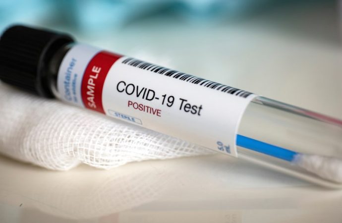 Coronavirus :  6902 cas confirmés, 145 décès