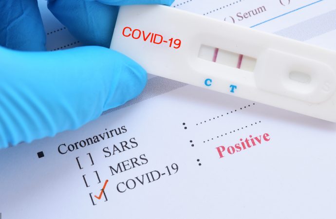 Coronavirus : 7476 cas enregistrés, 165 morts au total