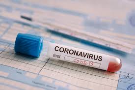 Haïti compte 8224 cas de coronavirus