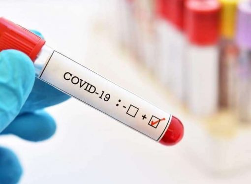 Coronavirus : 28 nouveaux cas de contamination et un décès