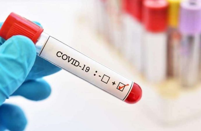 Coronavirus : 28 nouveaux cas de contamination et un décès