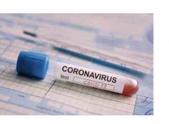 Haïti-Coronavirus : aucun nouveau cas enregistré durant les dernières 24 heures !
