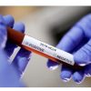 Covid-19 : le MSPP publie la liste des laboratoires habilités à réaliser les tests de dépistage