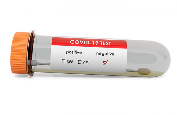 Coronavirus : Le gouvernement Biden-Harris maintient l’obligation faite aux voyageurs de présenter un test négatif