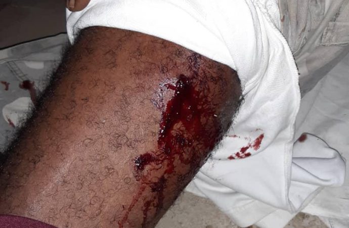 Gonaïves : un mort et cinq blessés au cours des échanges de tirs
