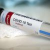 Covid-19 : un mort, 106 cas de contamination confirmés par le MSPP en moins d’une semaine