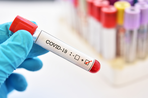 Covid 19 : le ministère de la santé publique confirme 12 nouveaux cas de contamination en 24 heures