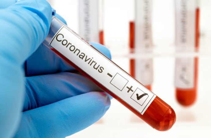 Santé : 14 nouveaux cas de coronavirus enregistrés
