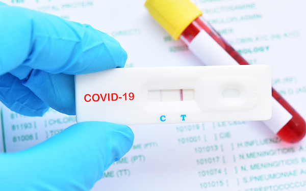 Covid 19 : six décès supplémentaires, 102 nouveaux cas de contamination confirmés