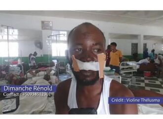 Séisme : Après avoir porté secours à 13 personnes, Renol Dimanche, blessé, sollicite de l’aide