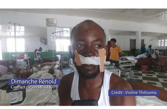 Séisme : Après avoir porté secours à 13 personnes, Renol Dimanche, blessé, sollicite de l’aide