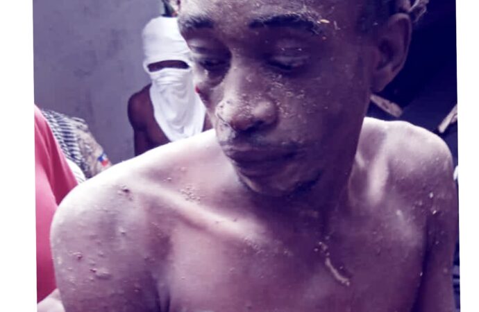 Port-au-Prince : plusieurs présumés bandits lynchés par la population