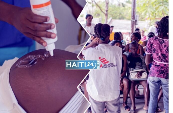 Sud : MSF vole au secours des femmes enceintes à Port-à-Piment